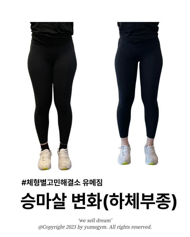 승마살 변화(하체부종)