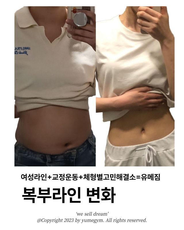 복부라인 변화